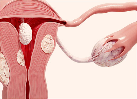 Illustration of female reproductive anatomy