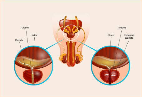 Illustration of urinary anatomy